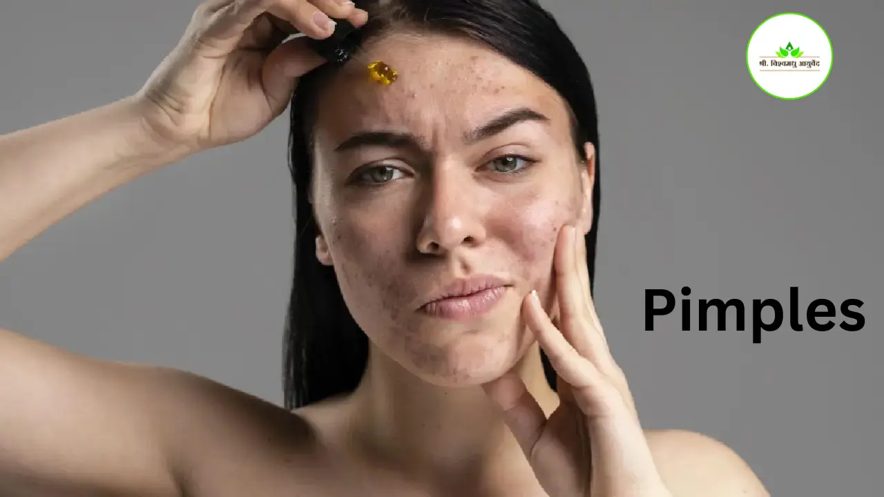 Pimples