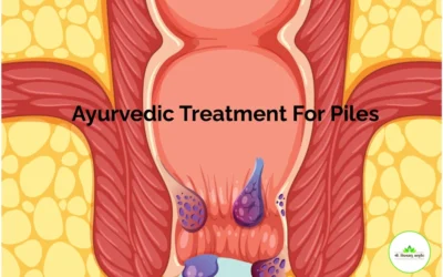 Ayurvedic Treatment for Piles (Hemorrhoids): A Natural, Long-Lasting Relief