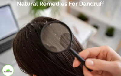 Natural Remedies for Dandruff: Ayurvedic and Home Treatments for a Healthy Scalp
